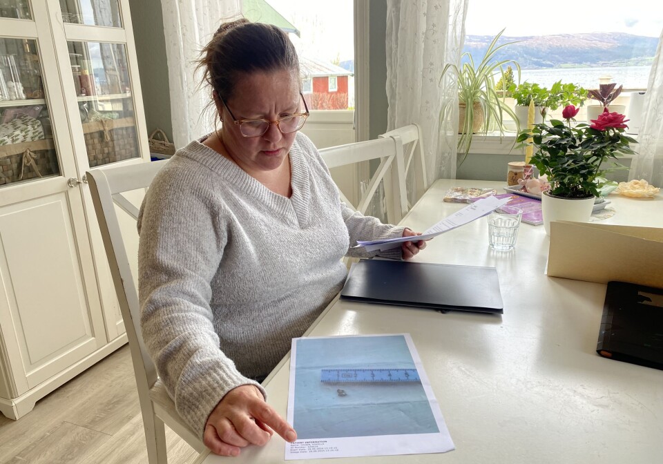 Camilla Hagen Strand sliter med daglige smerter etter at hun tygde på en metallbit i en lefse i fjor sommer.